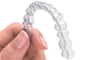 The Benefits of Invisalign