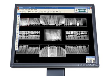 Digital X-Rays in Huntingburg, IN